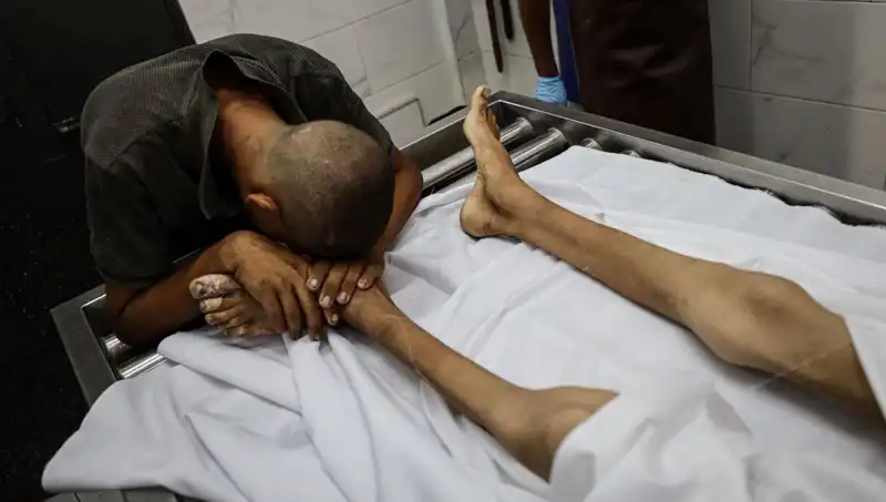 Gazze’de Açlık İle Mücadele: Bir Çocuğun Trajik Kaybı ve İnsani Kriz