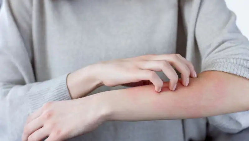 Gözden Kaçan Cilt Kanseri Belirtileri: Dermatologdan Önemli Uyarılar