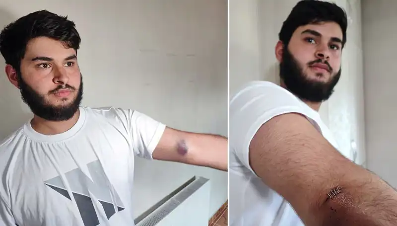 Mahallede Kaotik Anlar: Top Bahçeye Kaçınca Conolar Kamyonetle Geldi!